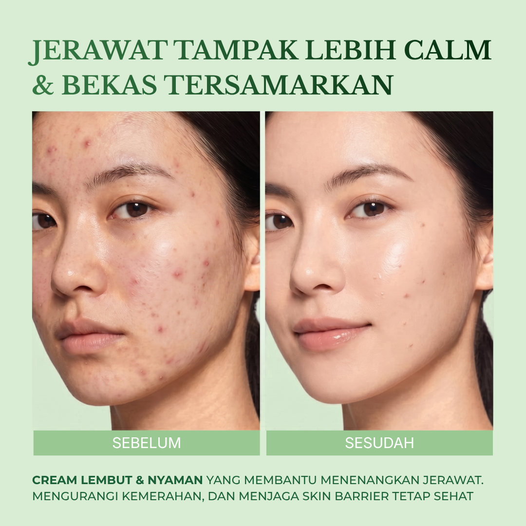 Derma Acne Care Cream gambar 6